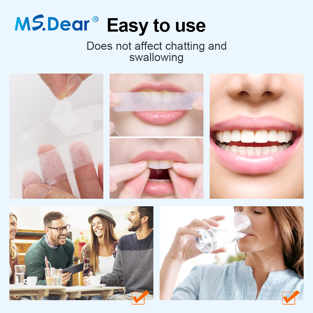 9D Teeth Whitening Strips – Gel Formula